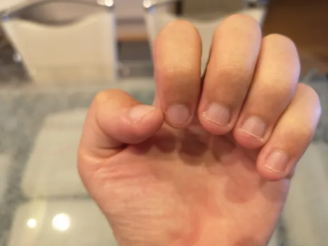 子どもの爪のイメージ画像